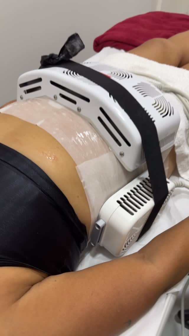 Tratamento de fisioterapia dermatofuncional no Studio Linda Mulher