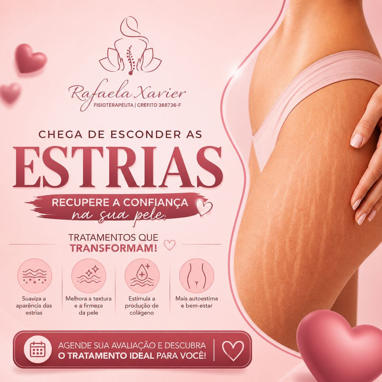 Destaques do Instagram da Dra. Rafaela Xavier, esteticista em Pouso Alegre