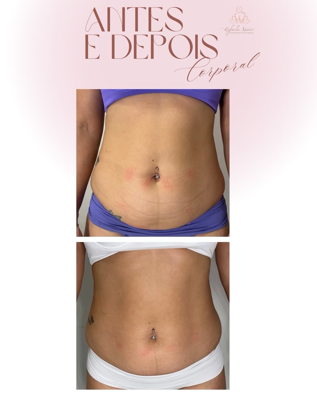 Protocolos exclusivos de estética e bem-estar corporal
